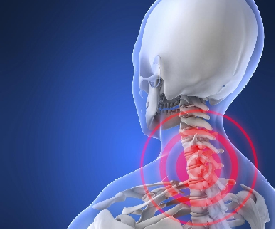 neck-pain